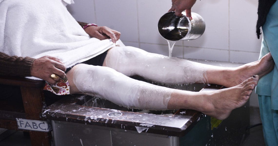 Treatment