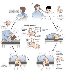 Vertigo / Vestibular Rehab
